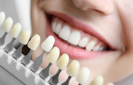 Estetica dental Clinica Dental Llona